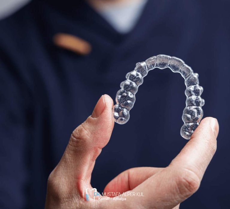 Şeffaf Plak (Invisalign) Tedavisi